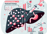 Citrato de Toremifeno et effets possibles sur les enzymes hépatiques : ce que dit la pratique